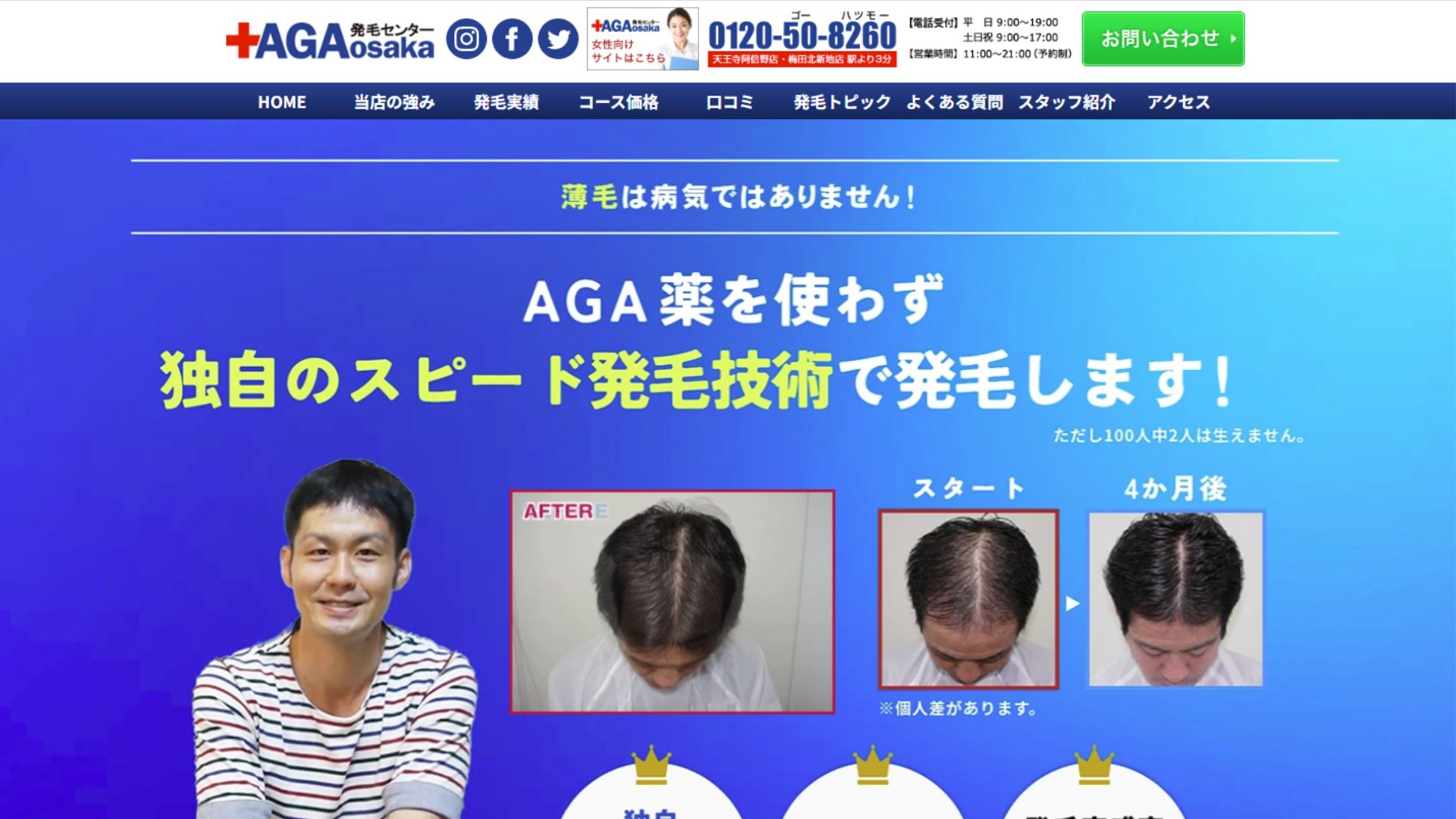 AGA大阪発毛センター天王寺阿倍野店